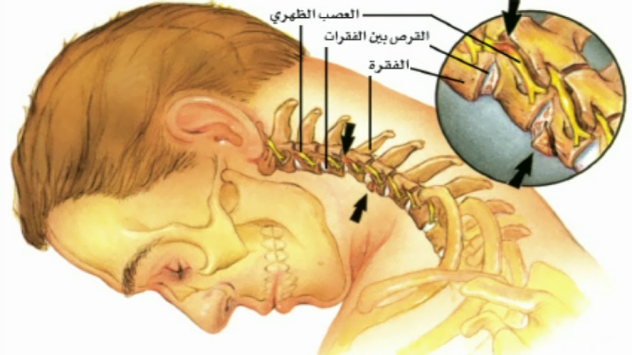 فوائد العلاج الطبيعي 8330