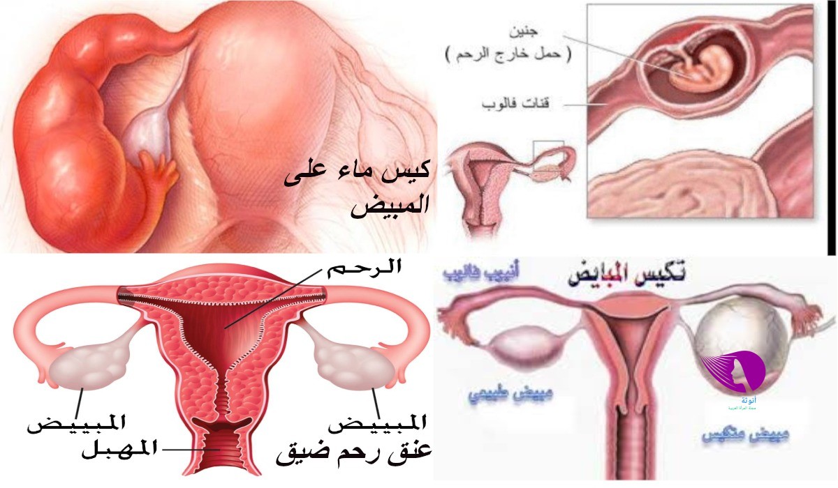 لو مش عندك أطفال وحملك متأخر هقولك السبب - ما سبب تاخر الحمل 8963 1