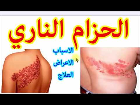 ماهو الحزام الناري بالصور - شكل الحزام النارى بالصور 9072 7